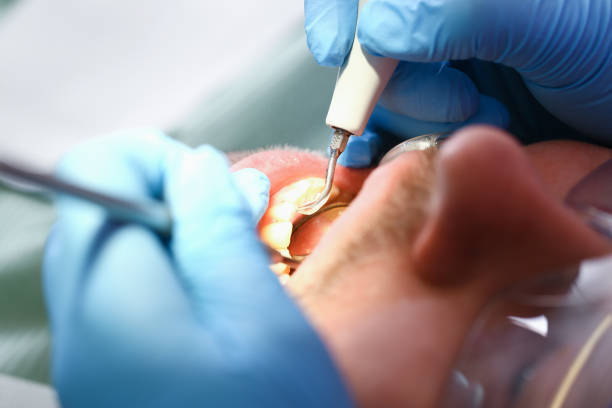 Best Emergency Treatment for Dental Infections or Abscesses in Wrightwood, CA